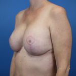 2142032-8of10