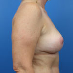 2142044-6of10