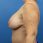 2142058-10of10
