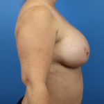 2142058-6of10