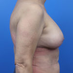 2142064-6of10