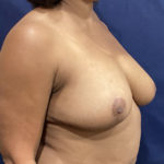 2142089-4of10
