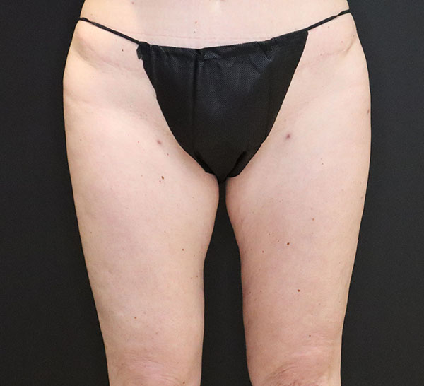 Black thong underwear on a neutral background, highlighting body confidence.