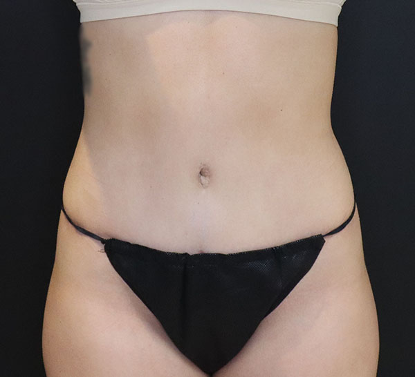 Black mesh bikini bottom on a neutral background, emphasizing body aesthetics.