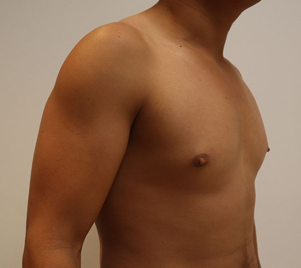 Male torso in profile, showcasing healthy physique and skin tone.