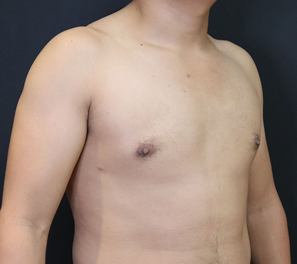 Male torso against a dark background, highlighting skin health and wellness.