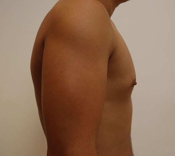 Close-up of a muscular arm, showcasing health and fitness.