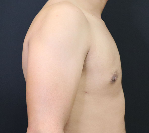 Male torso profile against a dark background, highlighting health and wellness.