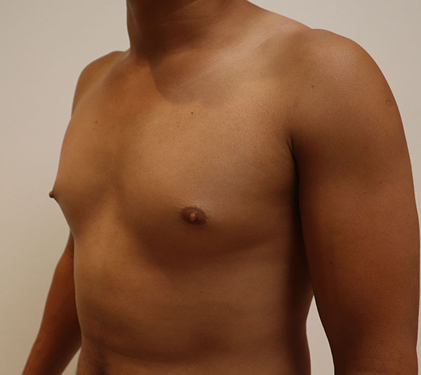 Male torso with natural skin tone, highlighting health and wellness focus.