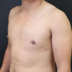Male torso against a dark background, emphasizing health and wellness.