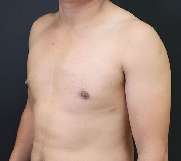 Male torso against a dark background, emphasizing health and wellness.