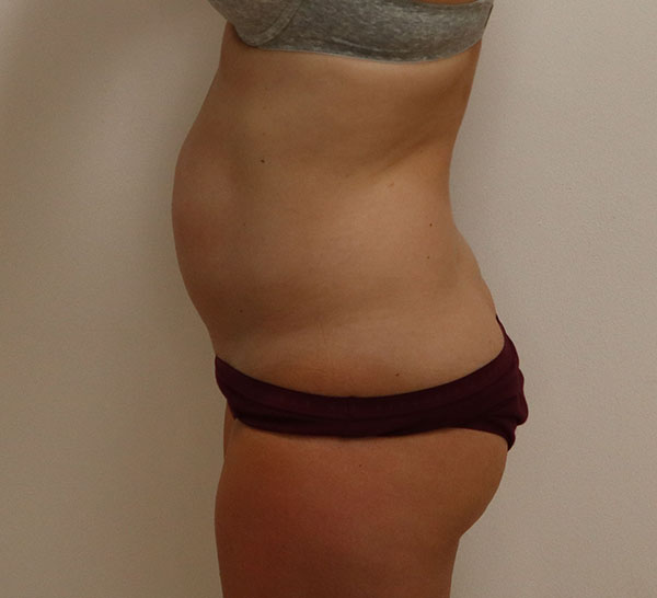 Patient profile highlighting abdominal area for consultation at Daniela Atencio, MD.