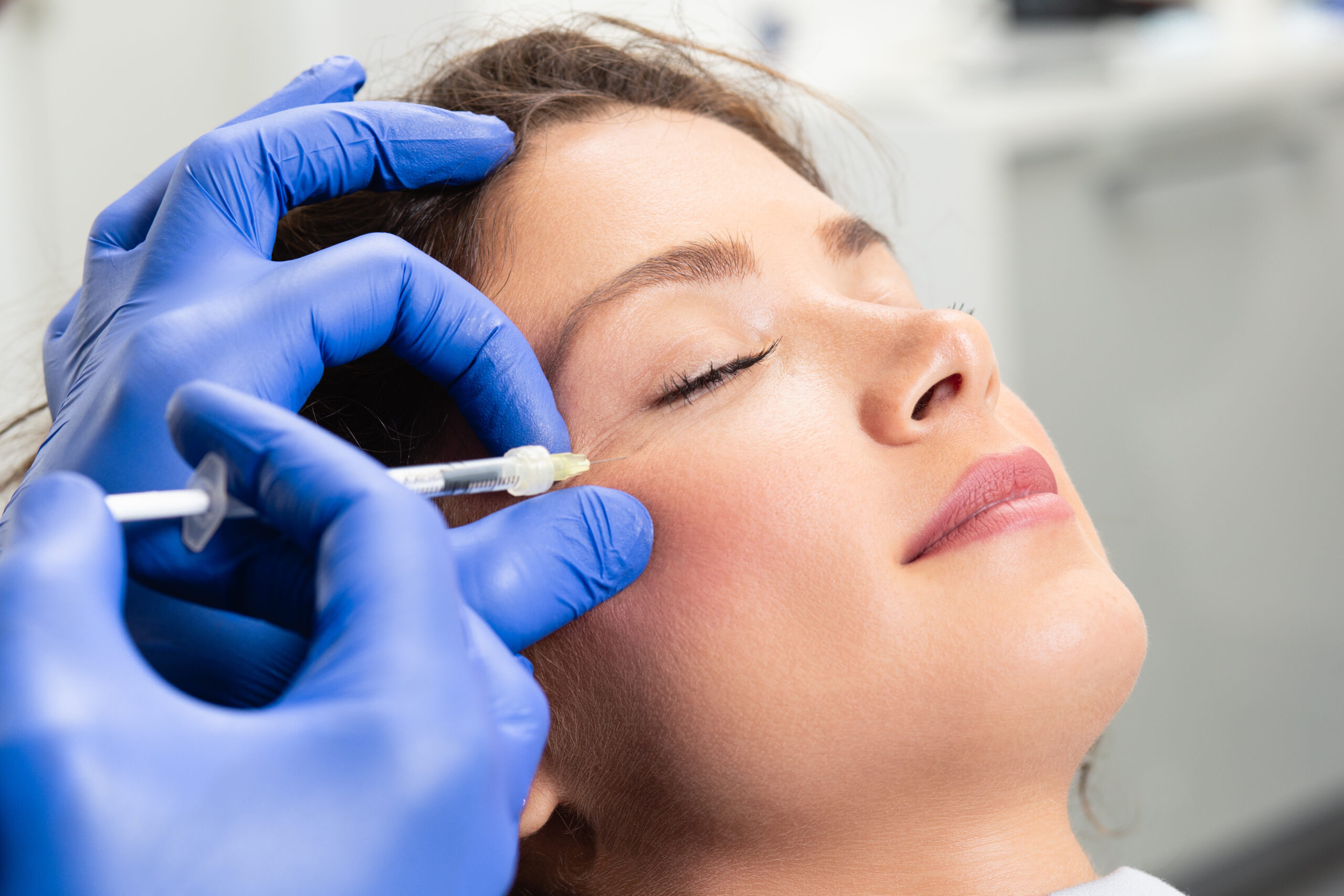 Attractive young woman is getting a rejuvenating facial injectio Perforation lines on females face, plastic surgery concept.